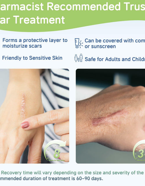 Load image into Gallery viewer, BestBy06/27 SLUKHIG Silicone Scar Gel 1.76oz Surgical &amp; Burn Scar TreatmentCream
