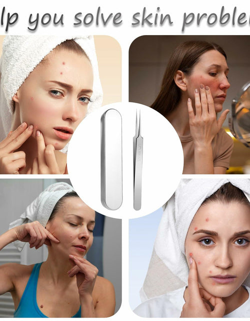 Load image into Gallery viewer, Bewudy 3Pc Stainless Steel Blackhead Remover Tweezers Kit Precision Tool

