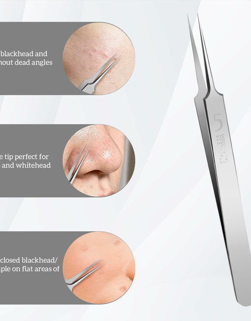 Load image into Gallery viewer, Bewudy 3Pc Stainless Steel Blackhead Remover Tweezers Kit Precision Tool
