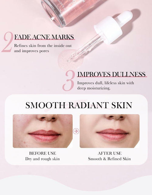 Load image into Gallery viewer, Moika Peach 70 Niacinamide Serum 30ml Hydrating Brightening Face Serum - New
