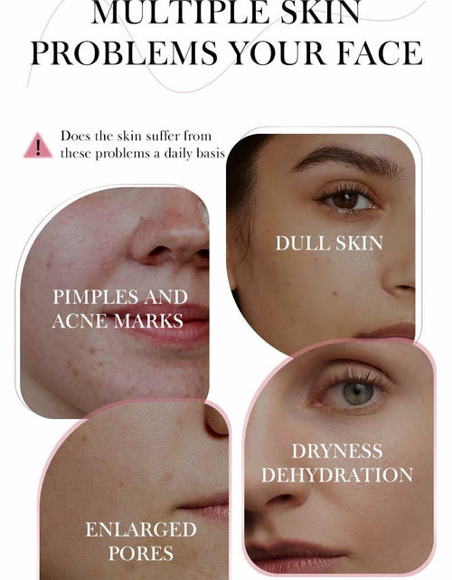 Load image into Gallery viewer, Moika Peach 70 Niacinamide Serum 30ml Hydrating Brightening Face Serum - New
