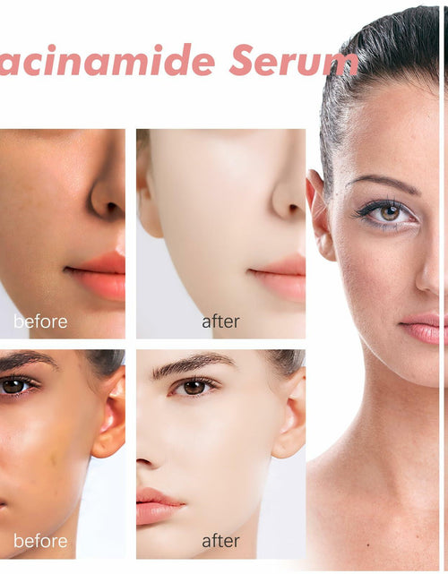 Load image into Gallery viewer, Moika Peach 70 Niacinamide Serum 30ml Hydrating Brightening Face Serum - New
