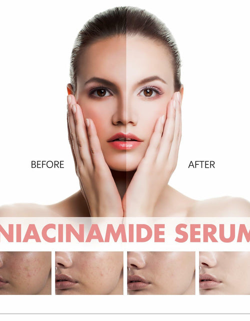 Load image into Gallery viewer, Moika Peach 70 Niacinamide Serum 30ml Hydrating Brightening Face Serum - New
