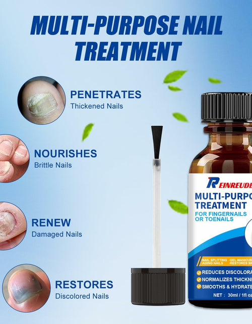 Load image into Gallery viewer, Wunila Toenail Fungus Treatment Extra Strength 30ml Multi-Purpose Nail Repair
