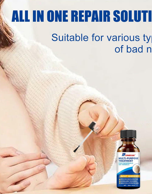 Load image into Gallery viewer, Wunila Toenail Fungus Treatment Extra Strength 30ml Multi-Purpose Nail Repair
