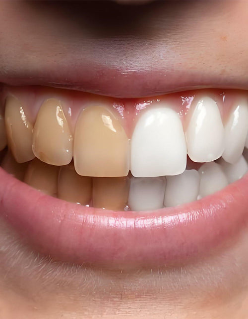Load image into Gallery viewer, ABYST Toothpaste Tablets Fluoride-Free Whitening Nano Hydroxyapatite 62Ct
