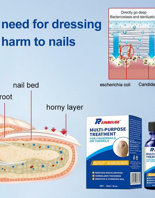 Load image into Gallery viewer, BestBy01/27 Toenail Fungus Treatment Extra Strength with Tolnaftate MultiPurpose
