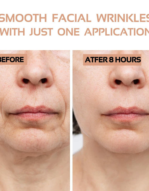 Load image into Gallery viewer, ENROSLU Face Wrinkle Patches 256Pcs Clear Reusable Anti-Wrinkle Treatment
