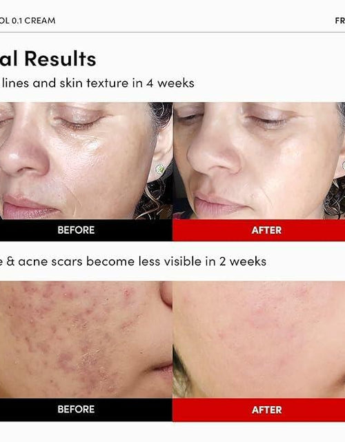 Load image into Gallery viewer, BestBy12/26 FRANKLY Retinol 0.1% Cream 1.01oz Night Anti-Aging Korean Skin Care
