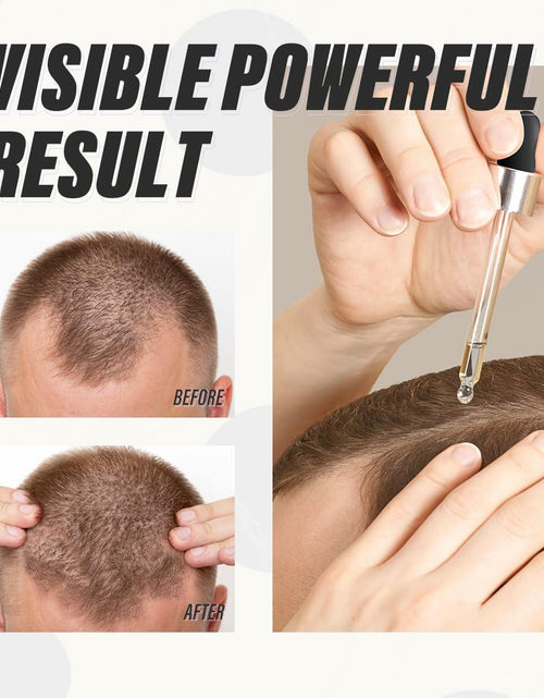 Load image into Gallery viewer, BEST BY 03/12/2027 HOPEMATE Biotin Hair Growth Serum 3.21oz Natural Ingredients
