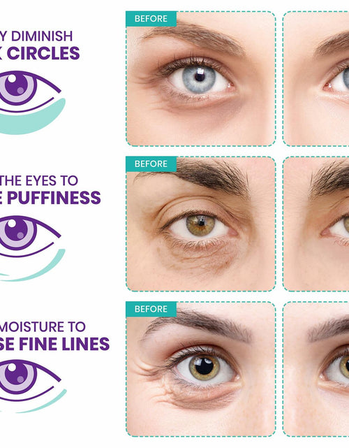 Load image into Gallery viewer, Stylia Under Eye Patches Marine Collagen Retinol Vitamin C Hyaluronic 6 Pairs
