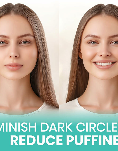 Load image into Gallery viewer, Stylia Under Eye Patches Marine Collagen Retinol Vitamin C Hyaluronic 6 Pairs
