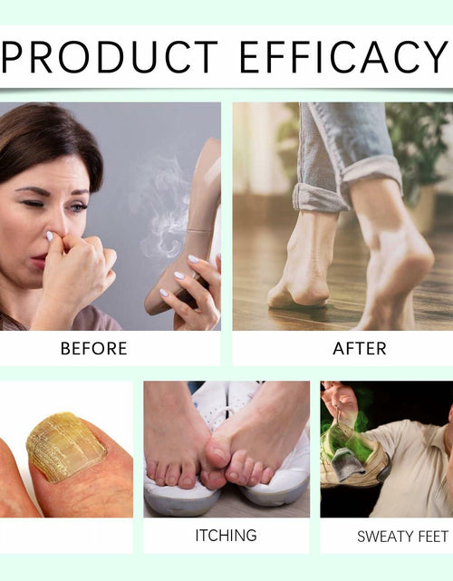 Load image into Gallery viewer, Generic Foot Sanitizer Spray with Tea Tree Oil Clear 1PCS
