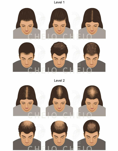 Load image into Gallery viewer, Cheio Hair Thickening Fibers Keratin Level 1 Dark Brown 27.5g Bald Spots
