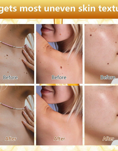 Load image into Gallery viewer, Plresen Bee Venom Skin Treatment Spray Hydrating Moisturizing 2.02oz 2PCS
