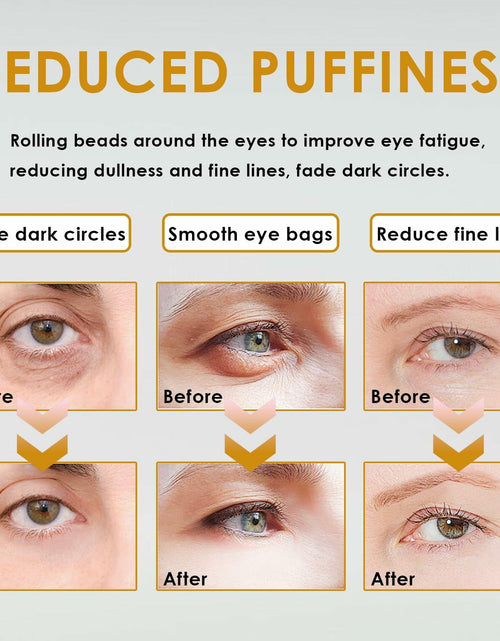 Load image into Gallery viewer, WEEMAY Eye Essence Castor &amp; Frankincense Oil Roller Ball 0.33oz 3 Pcs
