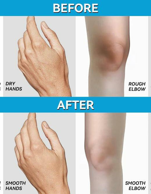 Load image into Gallery viewer, Scientific Solutions Global Urea 40% + 1% Hyaluronic Acid Cream 4oz Clear
