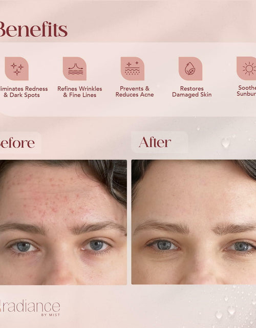 Load image into Gallery viewer, Radiance Snail Mucin Serum 96% Mucin Hyaluronic Acid 100ml Korean Skin Care LIKE
