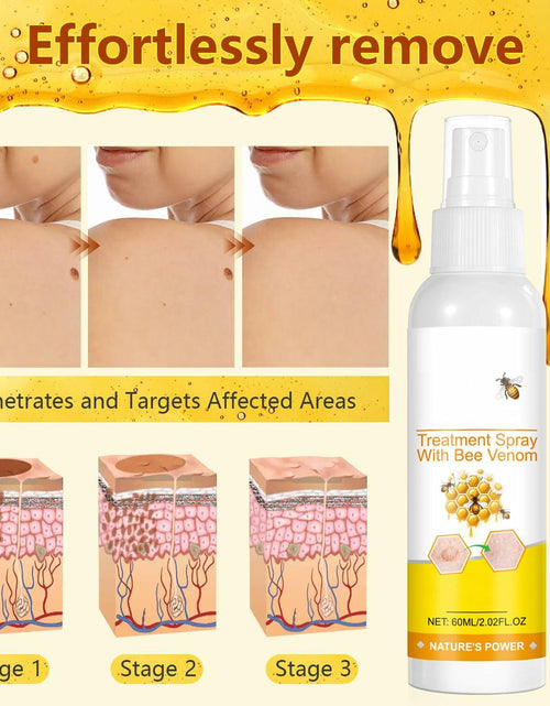 Load image into Gallery viewer, Plresen Bee Venom Skin Treatment Spray Hydrating Moisturizing 2.02oz 2PCS
