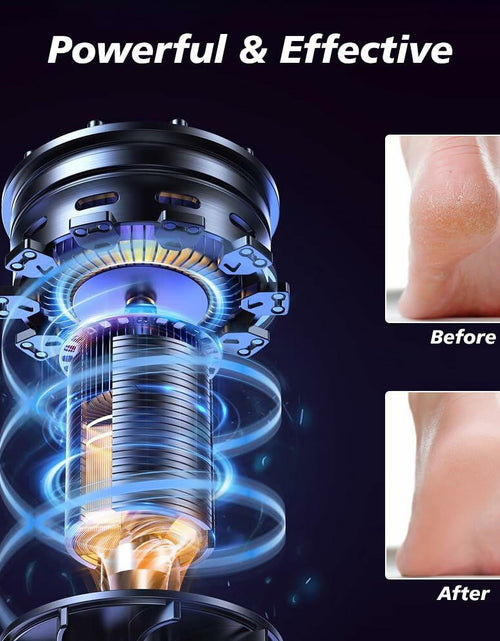 Load image into Gallery viewer, Yreihn Electric Callus Remover for Feet Purple 1 Count ABS Material
