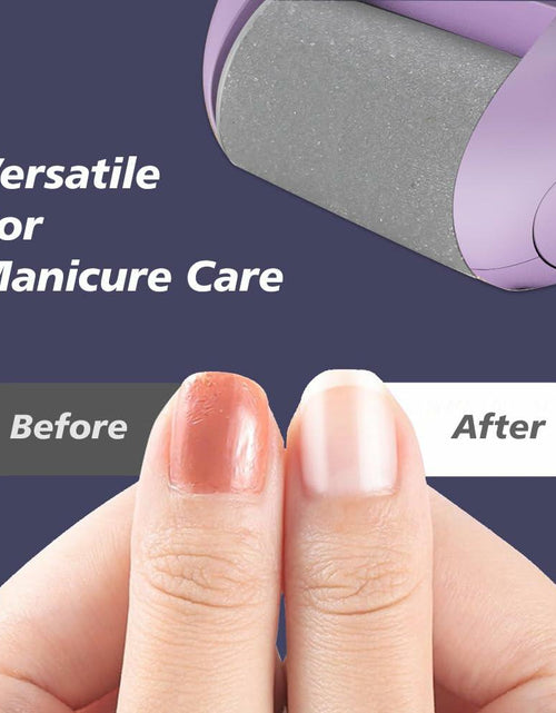 Load image into Gallery viewer, Yreihn Electric Callus Remover for Feet Purple 1 Count ABS Material
