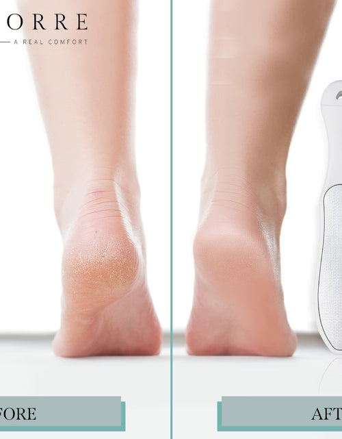 Load image into Gallery viewer, Riorre Professional 3-in-1 Foot Scrubber Callus Remover White Pack 1
