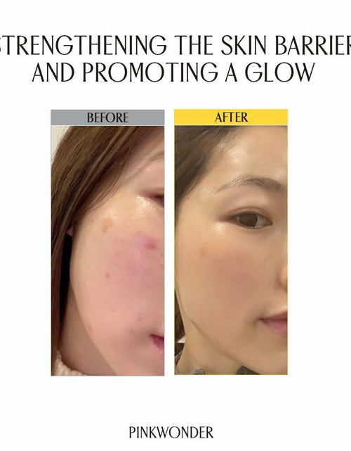 Load image into Gallery viewer, PINKWONDER Jojoba VitaCream 3.38oz Face Moisturizer B12 Panthenol Sensitive Skin
