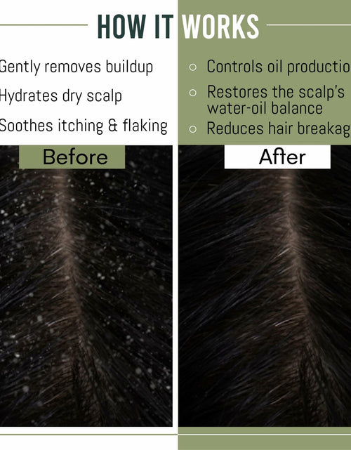 Load image into Gallery viewer, MagiForet Anti-Dandruff Shampoo &amp; Conditioner Set 2x500ml Dry Flaky Scalp
