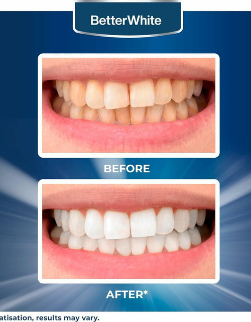 Load image into Gallery viewer, BetterWhite Teeth Whitening Strips 14 Peroxide-Free Professional 7 Treatments
