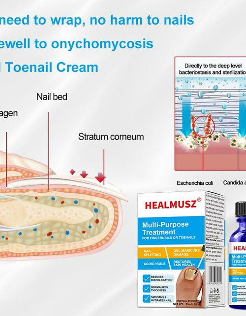 Load image into Gallery viewer, Toenail Fungus Treatment Extra Strength Nail Repair Foot Care
