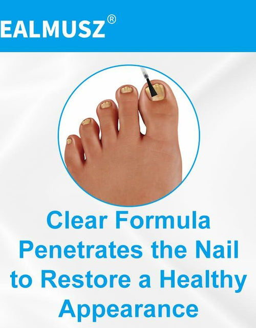Load image into Gallery viewer, Toenail Fungus Treatment Extra Strength Nail Repair Foot Care

