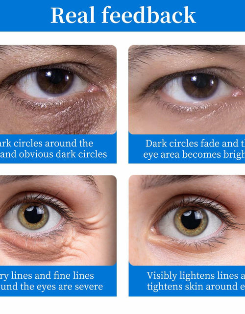 Load image into Gallery viewer, BLIGGLE Under Eye Patches 64 pcs Brightening Hyaluronic Acid Cooling Care
