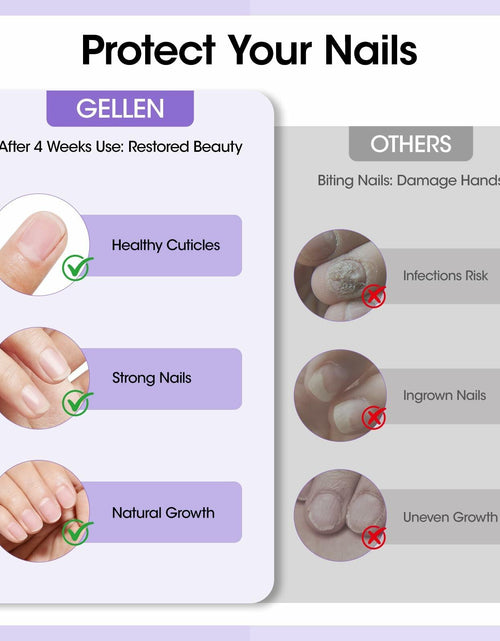 Load image into Gallery viewer, GELLEN Nail Biting Treatment Roll-On 10ml Quick Dry Water-Resistant
