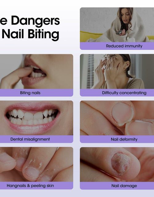 Load image into Gallery viewer, GELLEN Nail Biting Treatment Roll-On 10ml Quick Dry Water-Resistant
