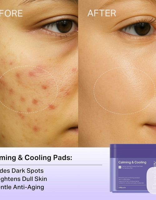 Load image into Gallery viewer, BestBy02/26 depology Blemish &amp; Tone Toner Pads 100 Pads Sensitive Skin
