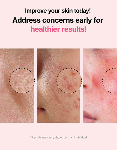 Load image into Gallery viewer, VEGANIFECT Pore Refining Ampoule Tightening Reduce Sebum 1.69oz
