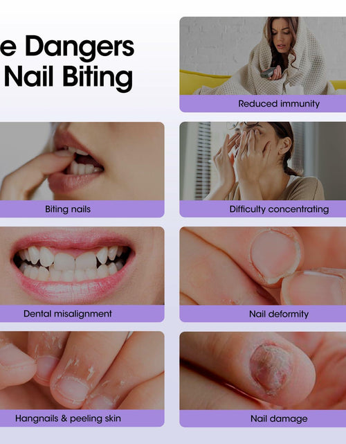 Load image into Gallery viewer, GELLEN Nail Biting Prevention Roll-On Treatment Bitter Taste 10ml

